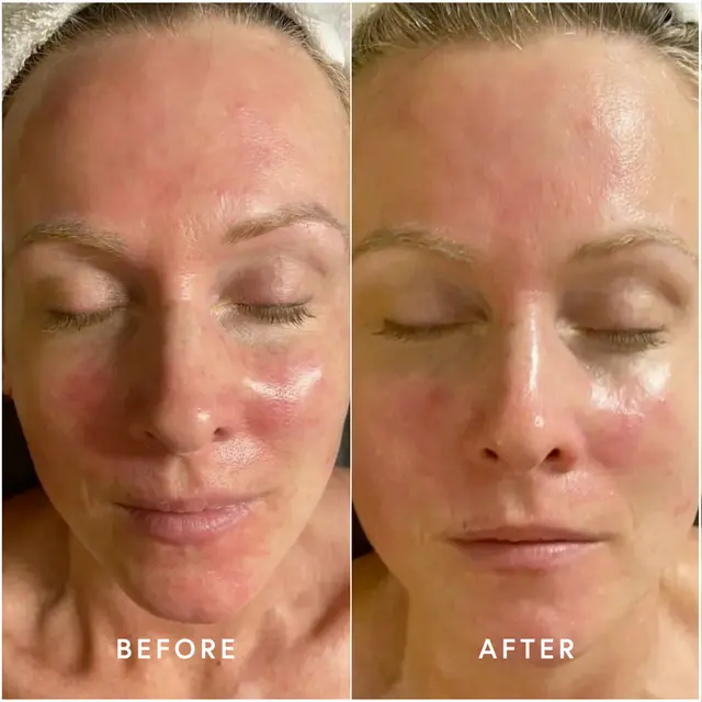 Epicutis Lipid Serum - Image 3